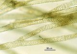 Choristocarpus tenellus4